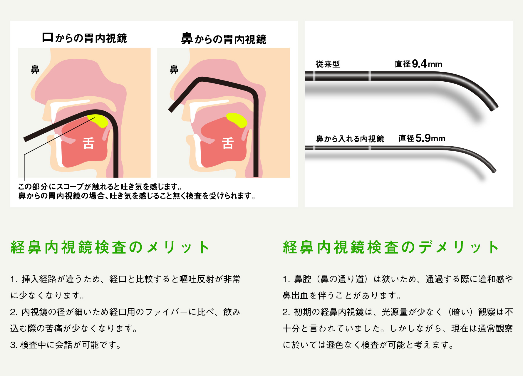 さいとう内科クリニック 経鼻内視鏡・大腸内視鏡